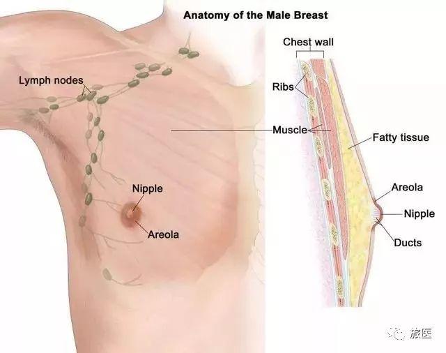 36歲女子胸部疙瘩揭示乳腺癌，早期發(fā)現(xiàn)與應(yīng)對至關(guān)重要