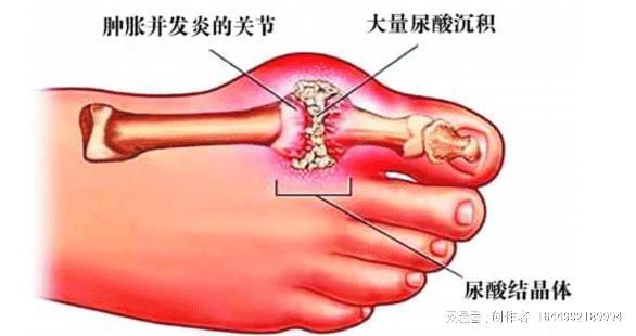 喝水促進(jìn)腎臟功能與新陳代謝平衡，關(guān)鍵所在