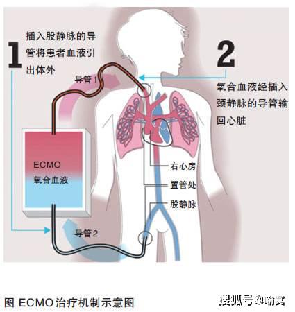 每天做幾分鐘深呼吸來改善肺部健康