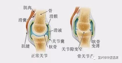 適量運動對骨骼長期強度的積極影響